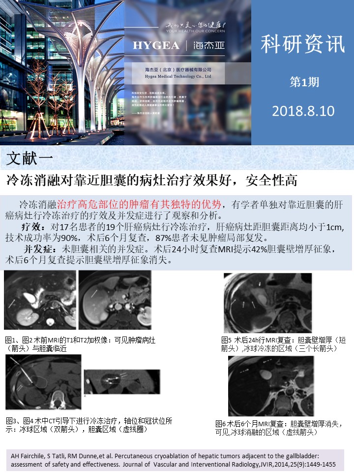【海杰亞科研資訊】第1期——肝、肺癌消融